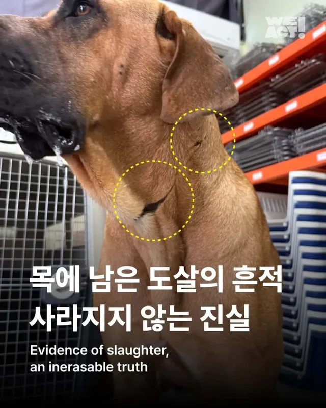 목에 남은 상처, 사라지지 않은 진실