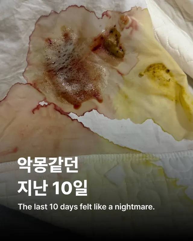 위액트에게 지난 10일은 정말 악몽 같은 시간이었습니다.