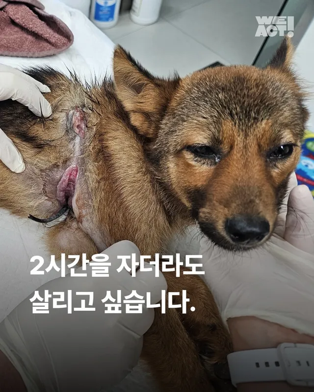 2시간을 자더라도 살리고 싶습니다.